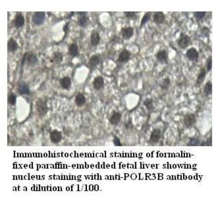 POLR3B Antibody from Signalway Antibody (39526) - Antibodies.com