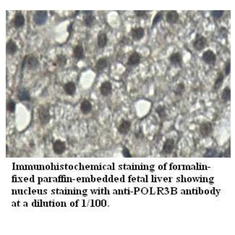 POLR3B Antibody from Signalway Antibody (39526) - Antibodies.com