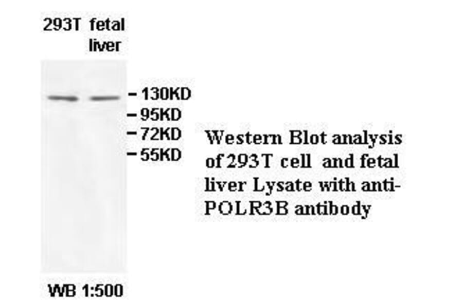 POLR3B Antibody from Signalway Antibody (39526) - Antibodies.com