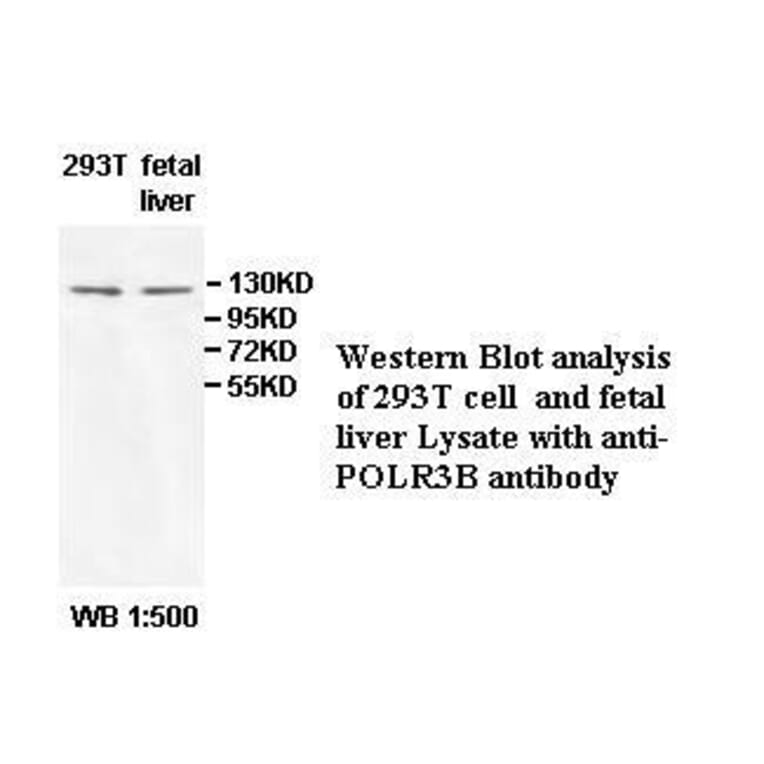 POLR3B Antibody from Signalway Antibody (39526) - Antibodies.com