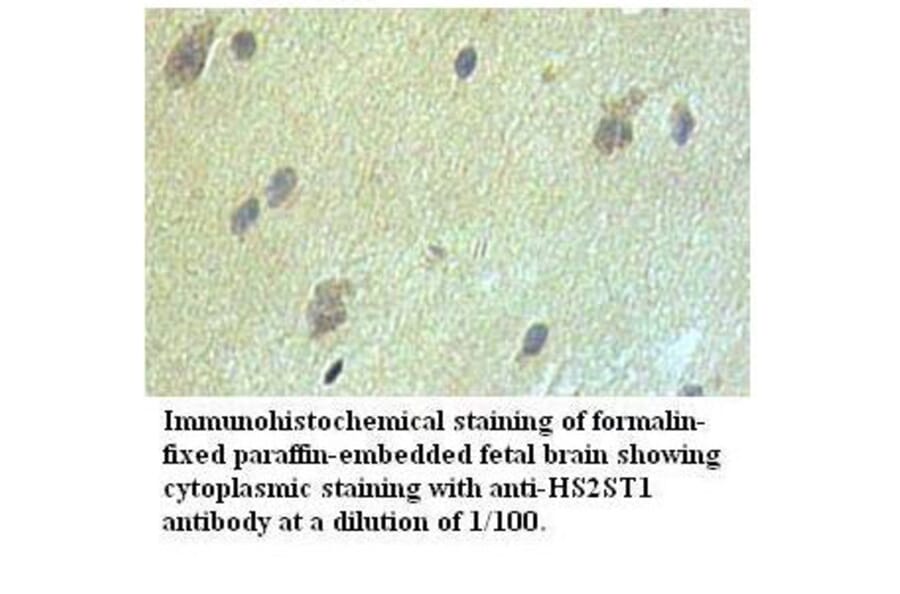 HS2ST1 Antibody from Signalway Antibody (39527) - Antibodies.com