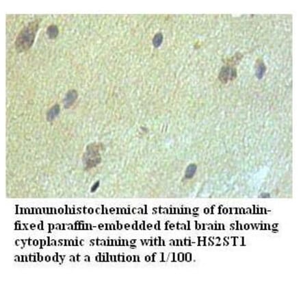 HS2ST1 Antibody from Signalway Antibody (39527) - Antibodies.com