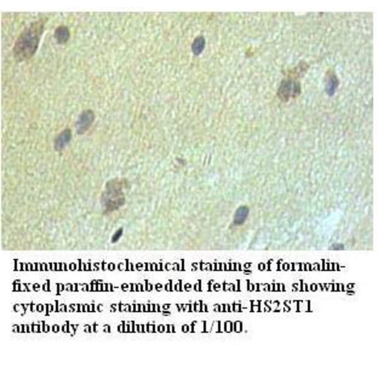 HS2ST1 Antibody from Signalway Antibody (39527) - Antibodies.com