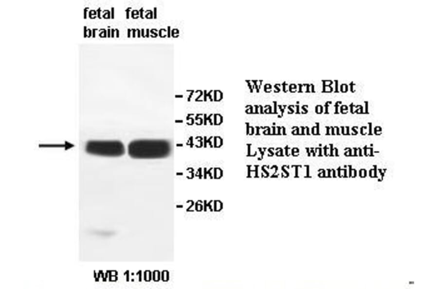 HS2ST1 Antibody from Signalway Antibody (39527) - Antibodies.com