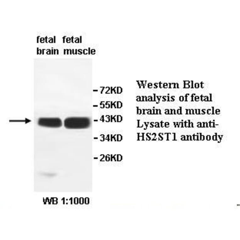 HS2ST1 Antibody from Signalway Antibody (39527) - Antibodies.com