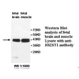 HS2ST1 Antibody from Signalway Antibody (39527) - Antibodies.com