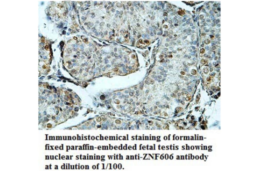 ZNF606 Antibody from Signalway Antibody (39689) - Antibodies.com