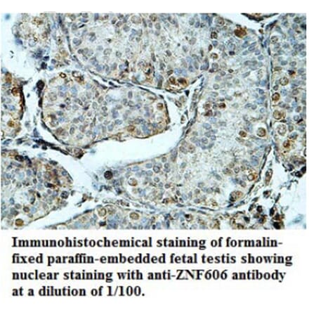 ZNF606 Antibody from Signalway Antibody (39689) - Antibodies.com