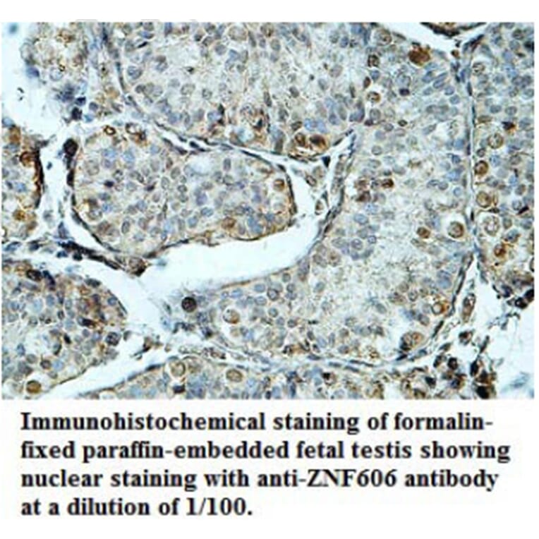 ZNF606 Antibody from Signalway Antibody (39689) - Antibodies.com