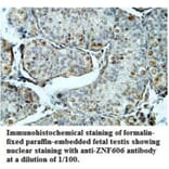 ZNF606 Antibody from Signalway Antibody (39689) - Antibodies.com