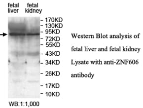Anti-ZNF606 Antibody (A47750) | Antibodies.com