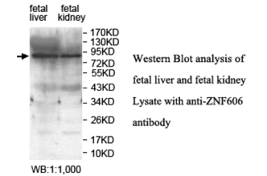 ZNF606 Antibody from Signalway Antibody (39689) - Antibodies.com
