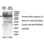 ZNF606 Antibody from Signalway Antibody (39689) - Antibodies.com
