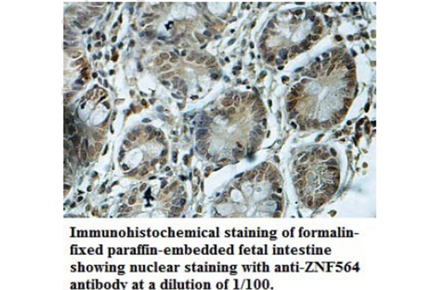 ZNF564 Antibody from Signalway Antibody (39690) - Antibodies.com