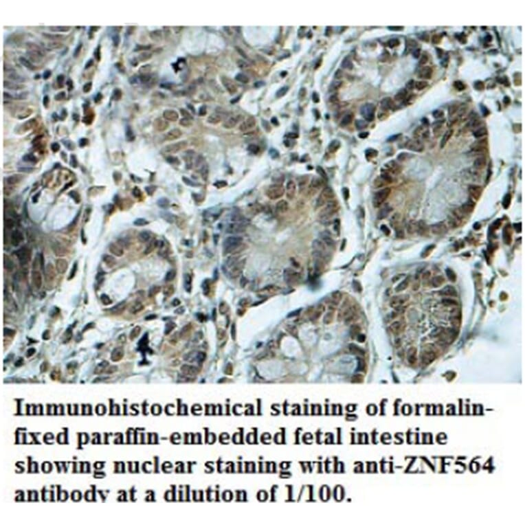ZNF564 Antibody from Signalway Antibody (39690) - Antibodies.com