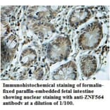 ZNF564 Antibody from Signalway Antibody (39690) - Antibodies.com