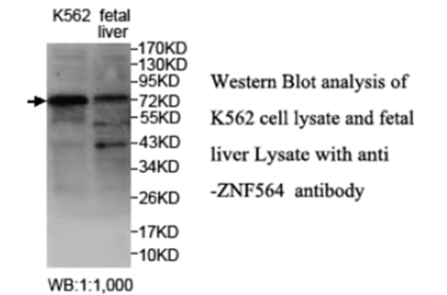 ZNF564 Antibody from Signalway Antibody (39690) - Antibodies.com