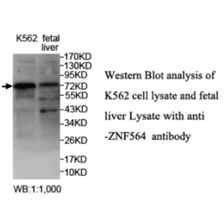 ZNF564 Antibody from Signalway Antibody (39690) - Antibodies.com