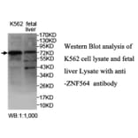 ZNF564 Antibody from Signalway Antibody (39690) - Antibodies.com