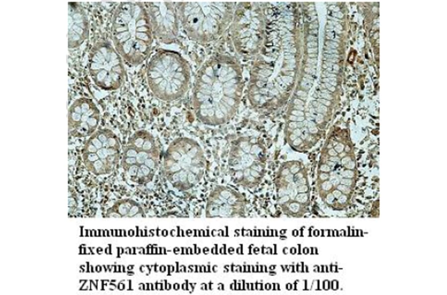 ZNF561 Antibody from Signalway Antibody (39691) - Antibodies.com