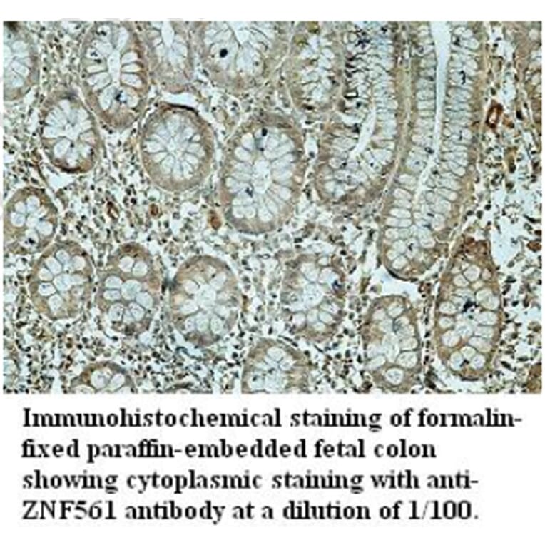 ZNF561 Antibody from Signalway Antibody (39691) - Antibodies.com