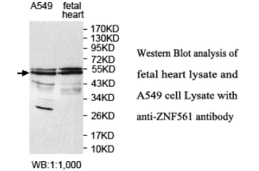 ZNF561 Antibody from Signalway Antibody (39691) - Antibodies.com