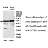 ZNF561 Antibody from Signalway Antibody (39691) - Antibodies.com