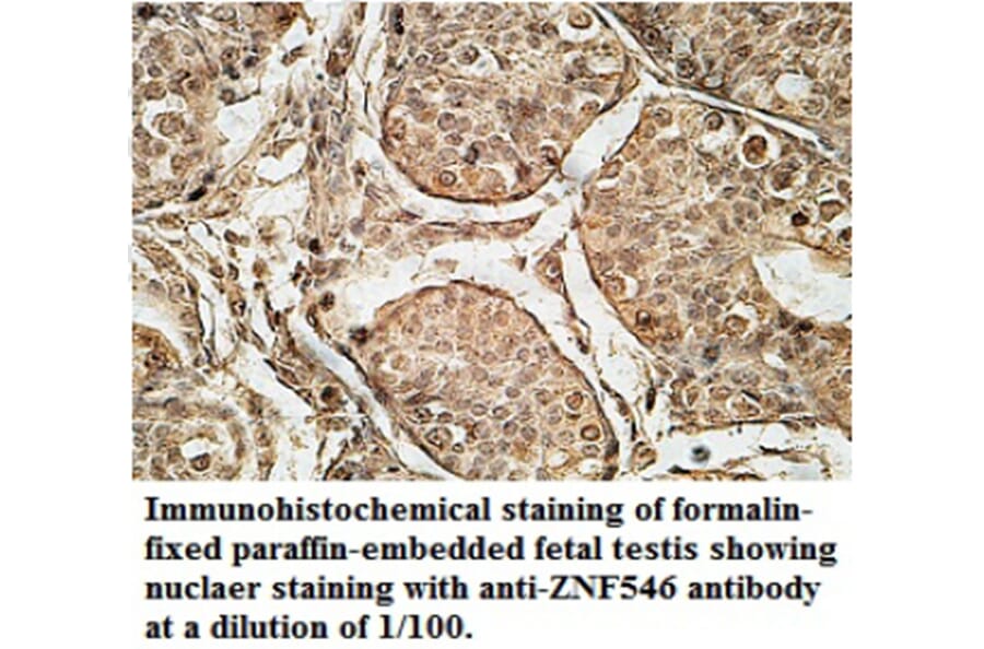 ZNF546 Antibody from Signalway Antibody (39692) - Antibodies.com