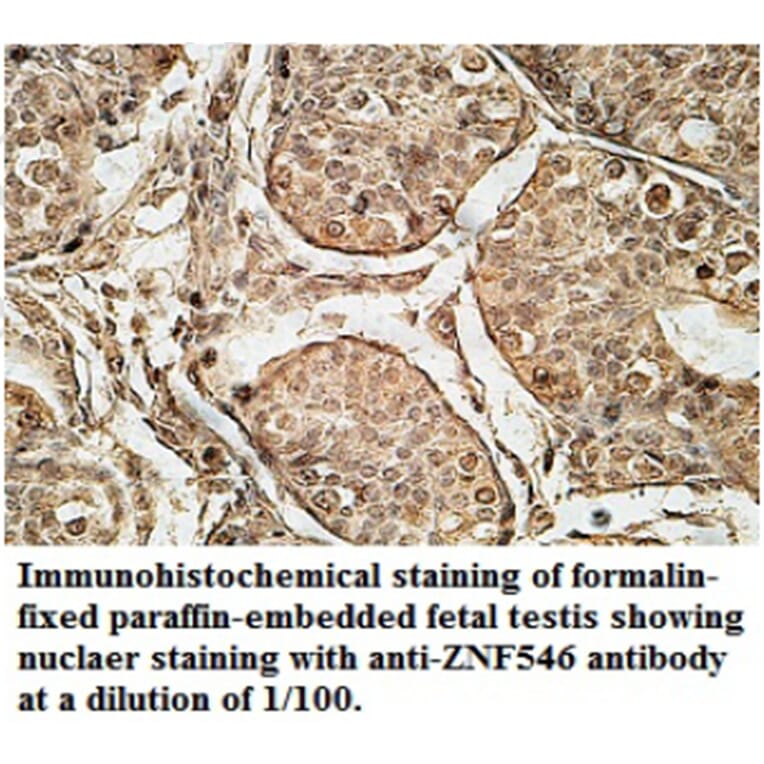 ZNF546 Antibody from Signalway Antibody (39692) - Antibodies.com