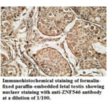 ZNF546 Antibody from Signalway Antibody (39692) - Antibodies.com