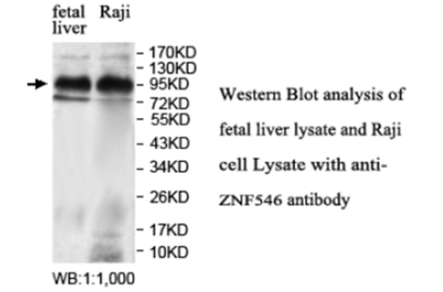 ZNF546 Antibody from Signalway Antibody (39692) - Antibodies.com
