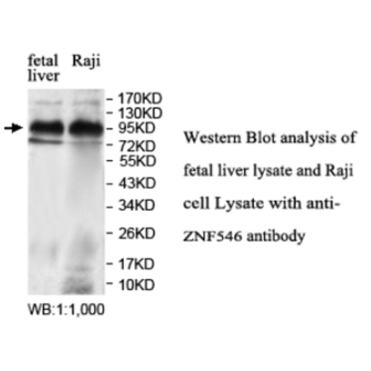 ZNF546 Antibody from Signalway Antibody (39692) - Antibodies.com