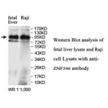 ZNF546 Antibody from Signalway Antibody (39692) - Antibodies.com