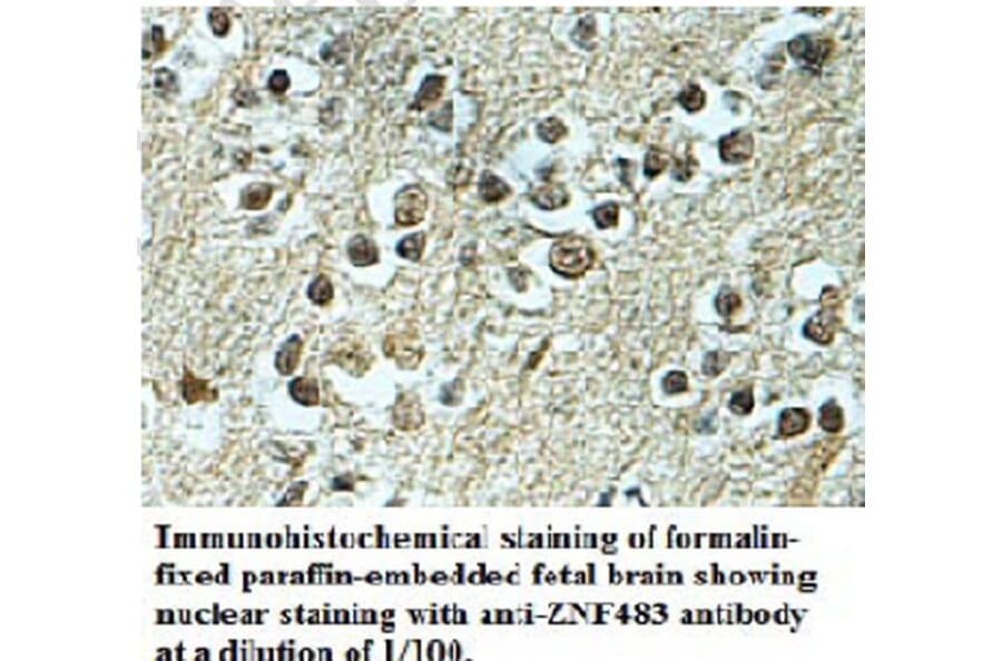 ZNF483 Antibody from Signalway Antibody (39693) - Antibodies.com