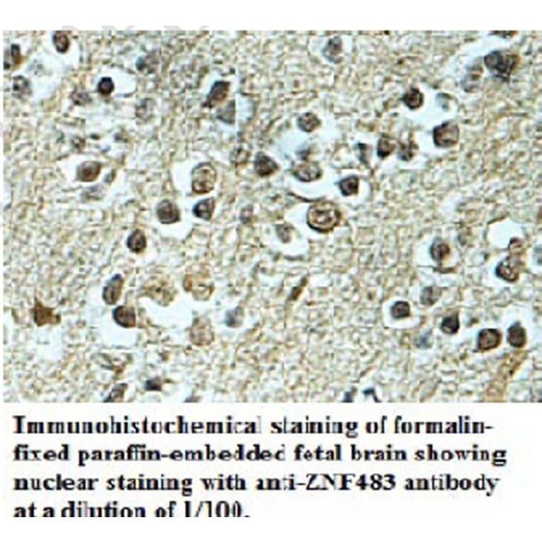 ZNF483 Antibody from Signalway Antibody (39693) - Antibodies.com