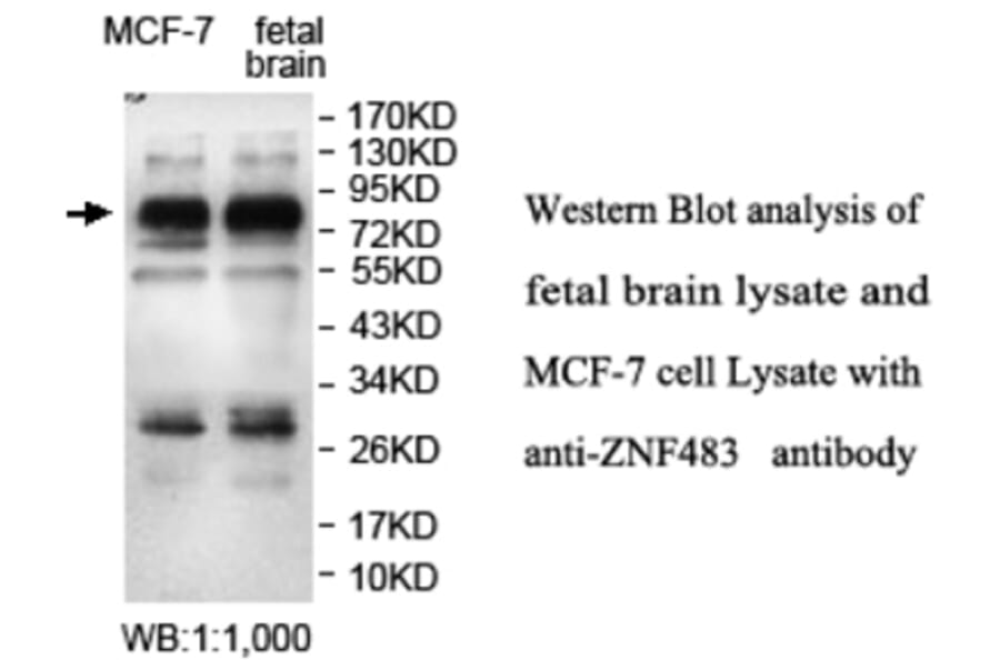 ZNF483 Antibody from Signalway Antibody (39693) - Antibodies.com