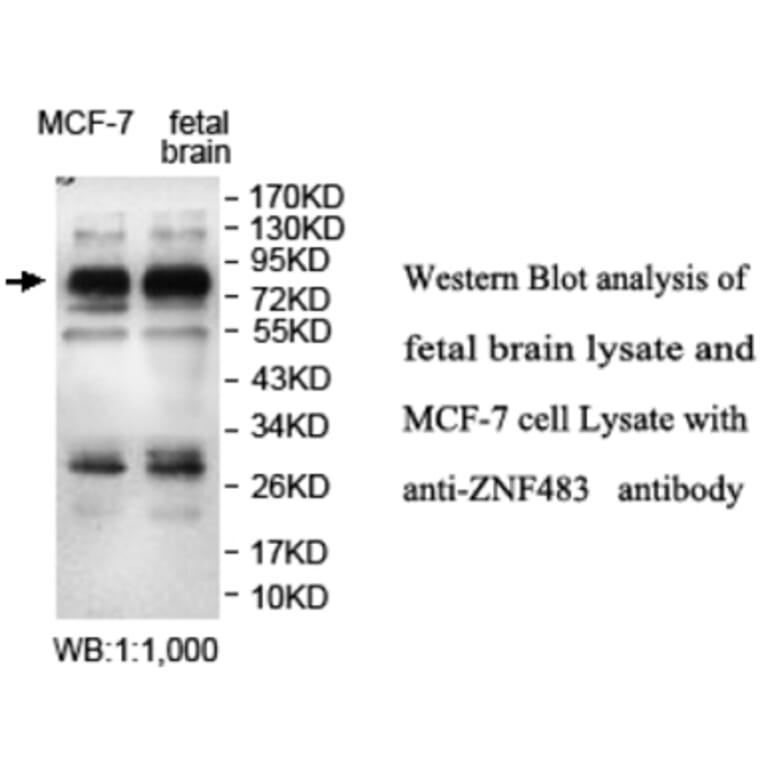 ZNF483 Antibody from Signalway Antibody (39693) - Antibodies.com