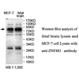 ZNF483 Antibody from Signalway Antibody (39693) - Antibodies.com