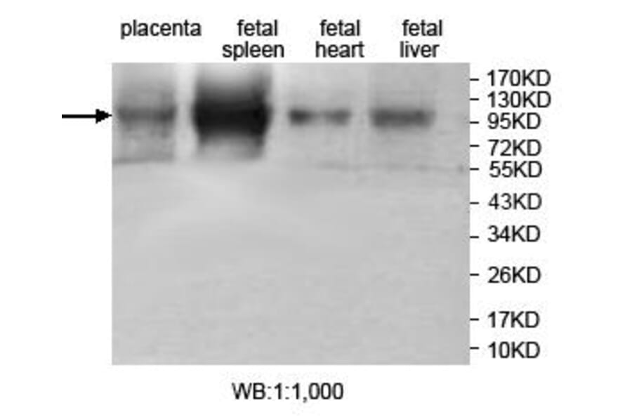 JHDM1D Antibody from Signalway Antibody (39707) - Antibodies.com