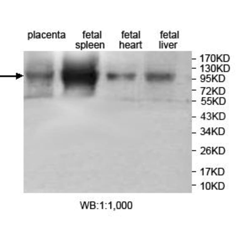 JHDM1D Antibody from Signalway Antibody (39707) - Antibodies.com