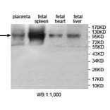 JHDM1D Antibody from Signalway Antibody (39707) - Antibodies.com