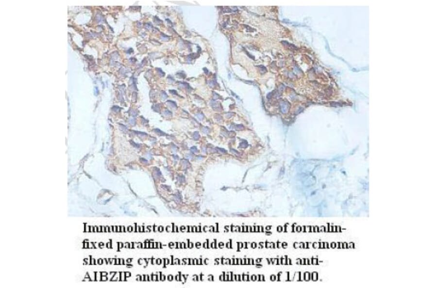 AIBZIP Antibody from Signalway Antibody (39715) - Antibodies.com