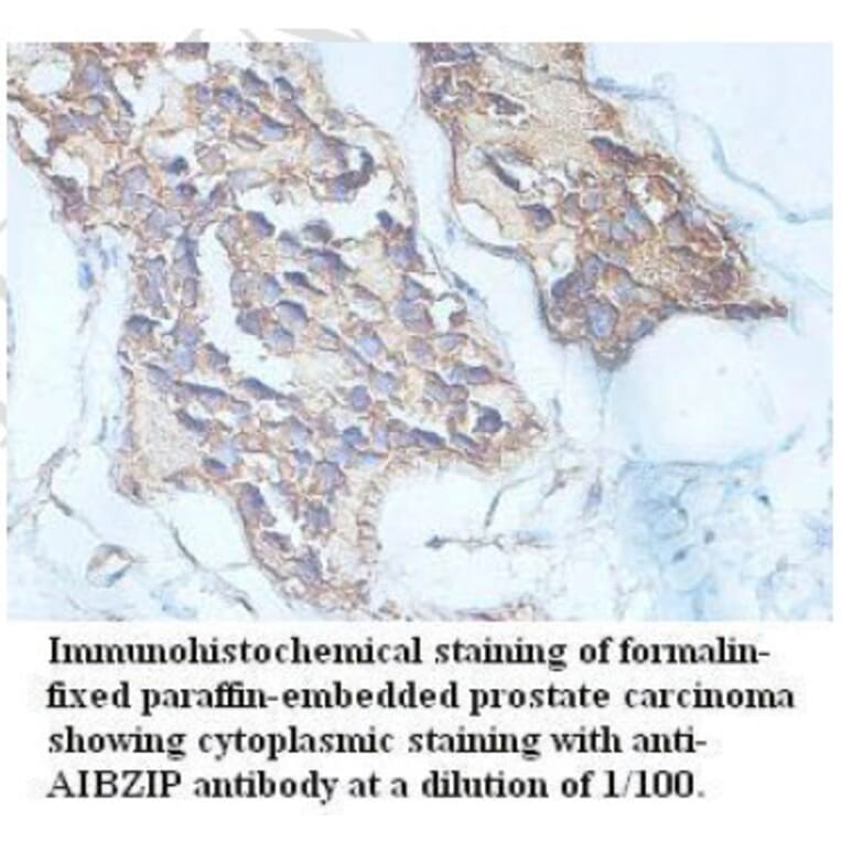 AIBZIP Antibody from Signalway Antibody (39715) - Antibodies.com