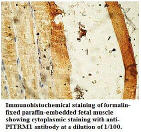 PITRM1 Antibody from Signalway Antibody (39736) - Antibodies.com