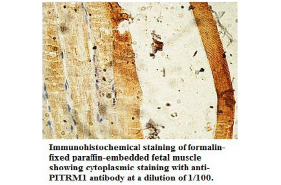PITRM1 Antibody from Signalway Antibody (39736) - Antibodies.com