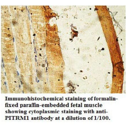 PITRM1 Antibody from Signalway Antibody (39736) - Antibodies.com