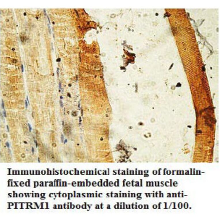 PITRM1 Antibody from Signalway Antibody (39736) - Antibodies.com