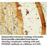 PITRM1 Antibody from Signalway Antibody (39736) - Antibodies.com