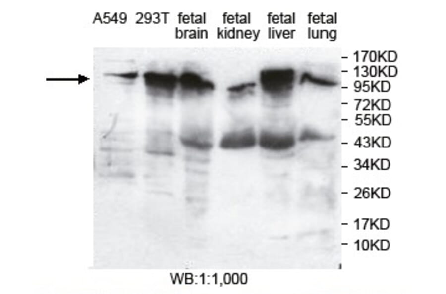 PITRM1 Antibody from Signalway Antibody (39736) - Antibodies.com