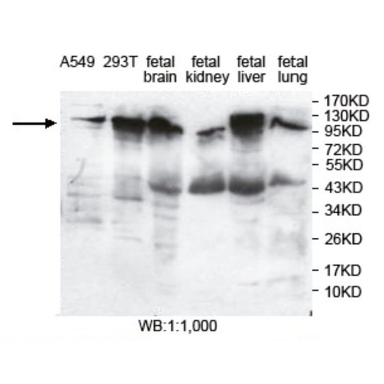PITRM1 Antibody from Signalway Antibody (39736) - Antibodies.com